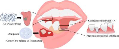 The applications of polysaccharides in <mark class="highlighted">dentistry</mark>